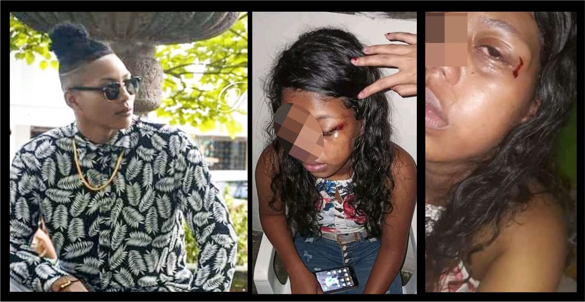 Menor de edad habría sido atacada a golpes por su compañero sentimental