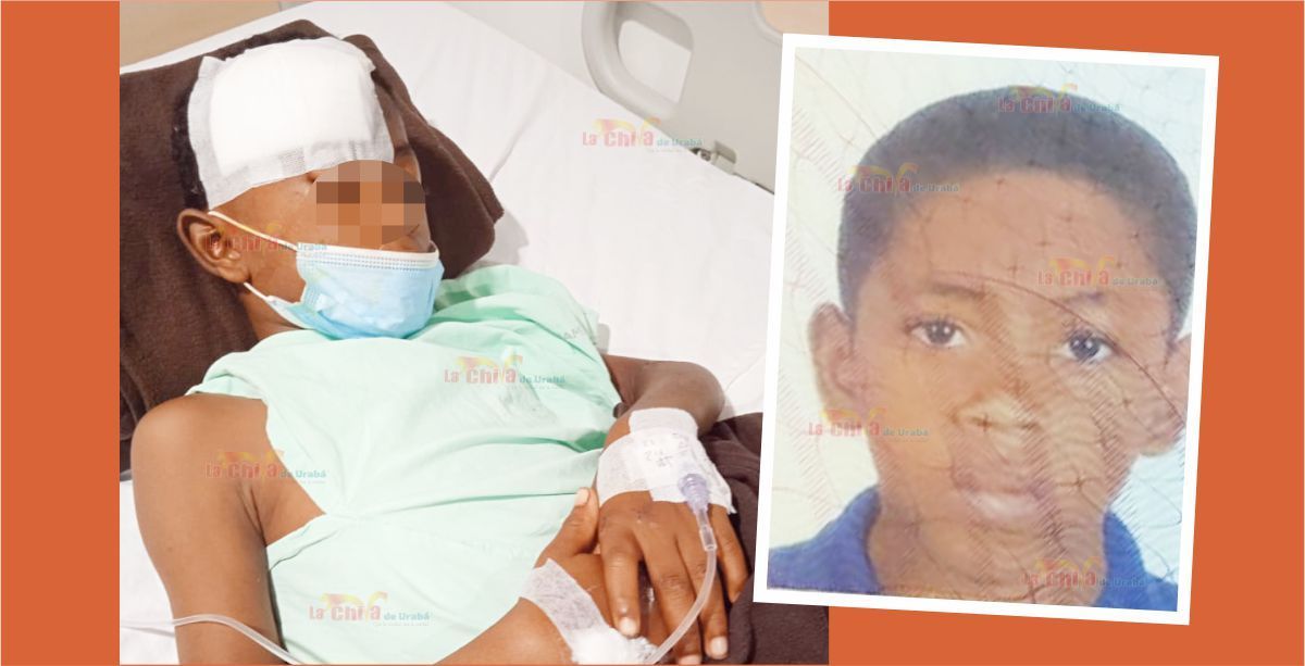 Niño atropellado por motociclista sin soat dejado a su suerte