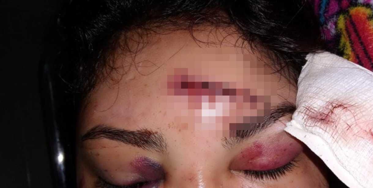 El novio le habría dicho que le tenía una sorpresa antes de atacarla a golpes