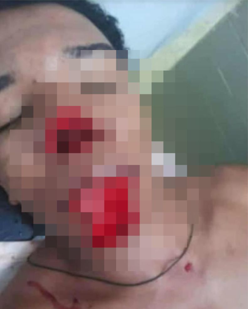 Imagen del artículo