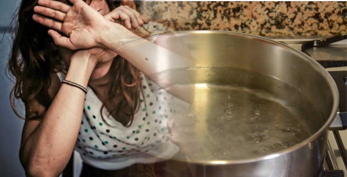 Tras discusión hombre terminó tirando agua caliente a la esposa