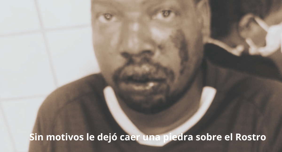 ¡Ojo, un loco anda suelto en Apartadó!  Agredió a Pedradas a “Nacho” y a un hombre de Chigorodó que hacía vueltas en Apartadó