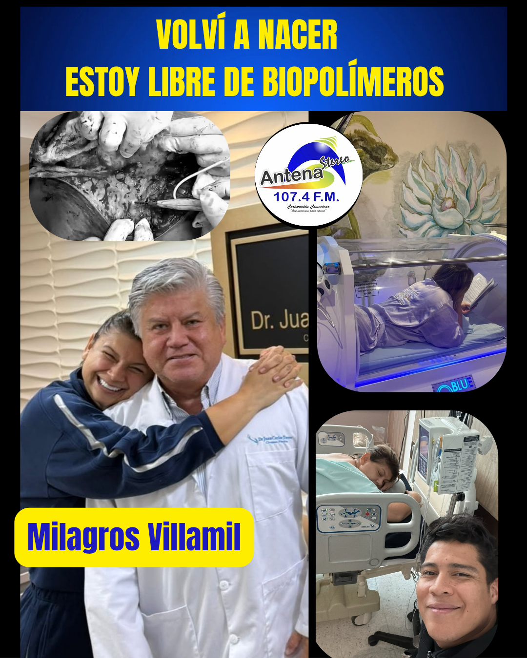 Milagro Villamil rompió el silencio: “Volví a nacer, estoy libre de biopolímeros”